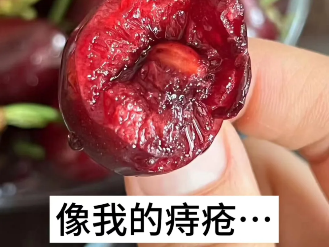 肛门口长了个小肉球怎么消除过来人经验分享