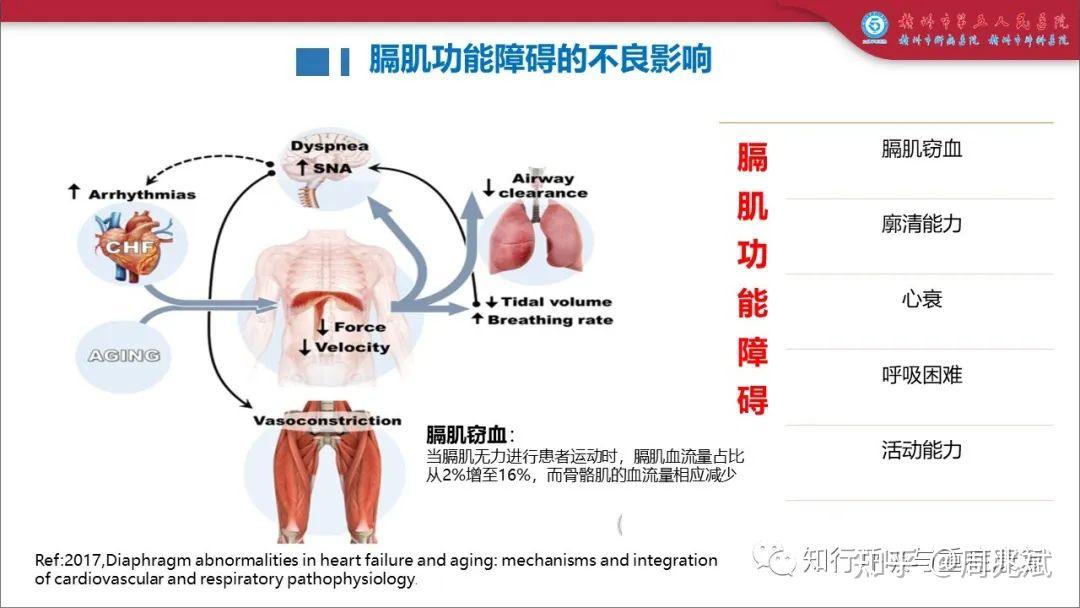 机械通气患者的吸气肌训练:循证与实践 - 知乎