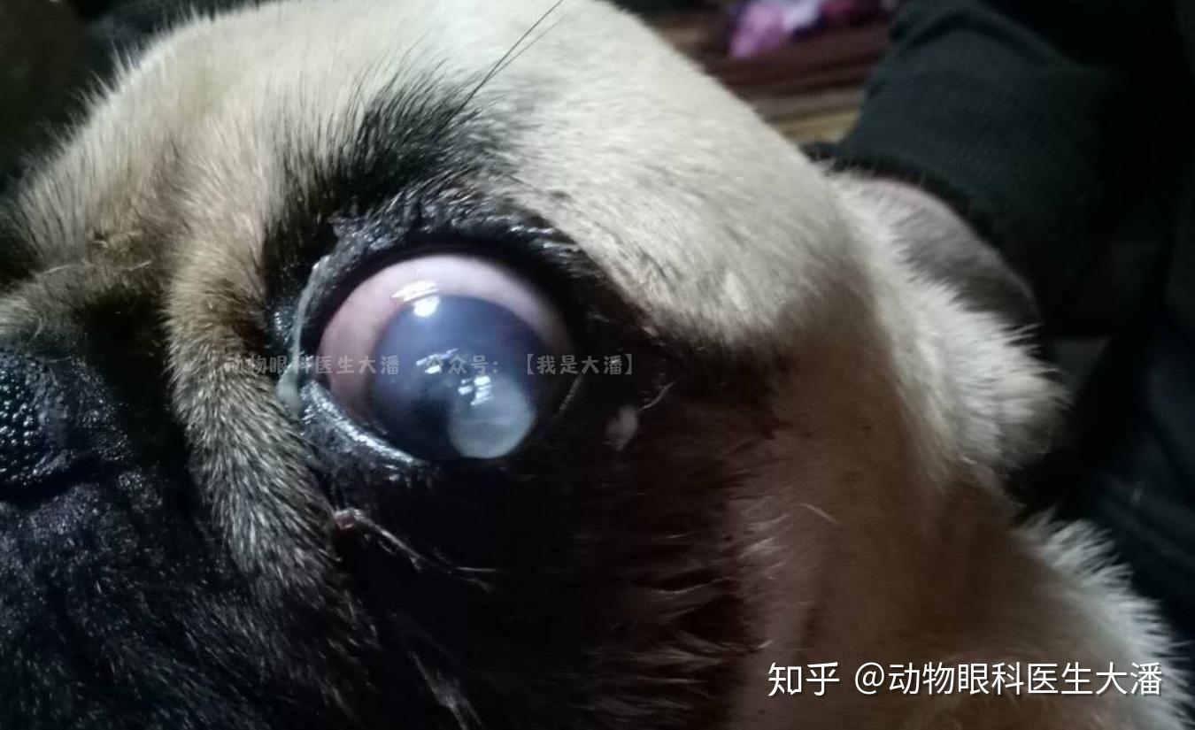 角膜溃疡治疗后成了角膜穿孔~我的心态崩了