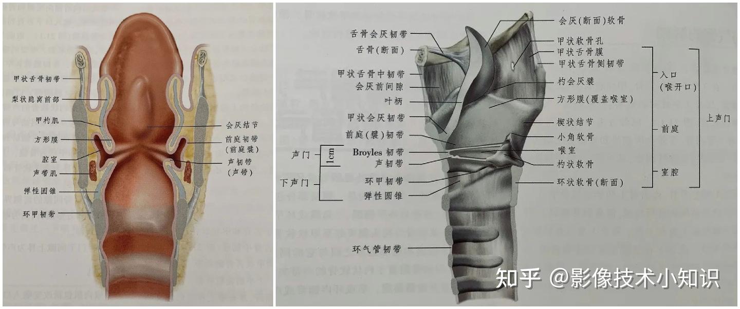 喉的CT解剖 - 知乎