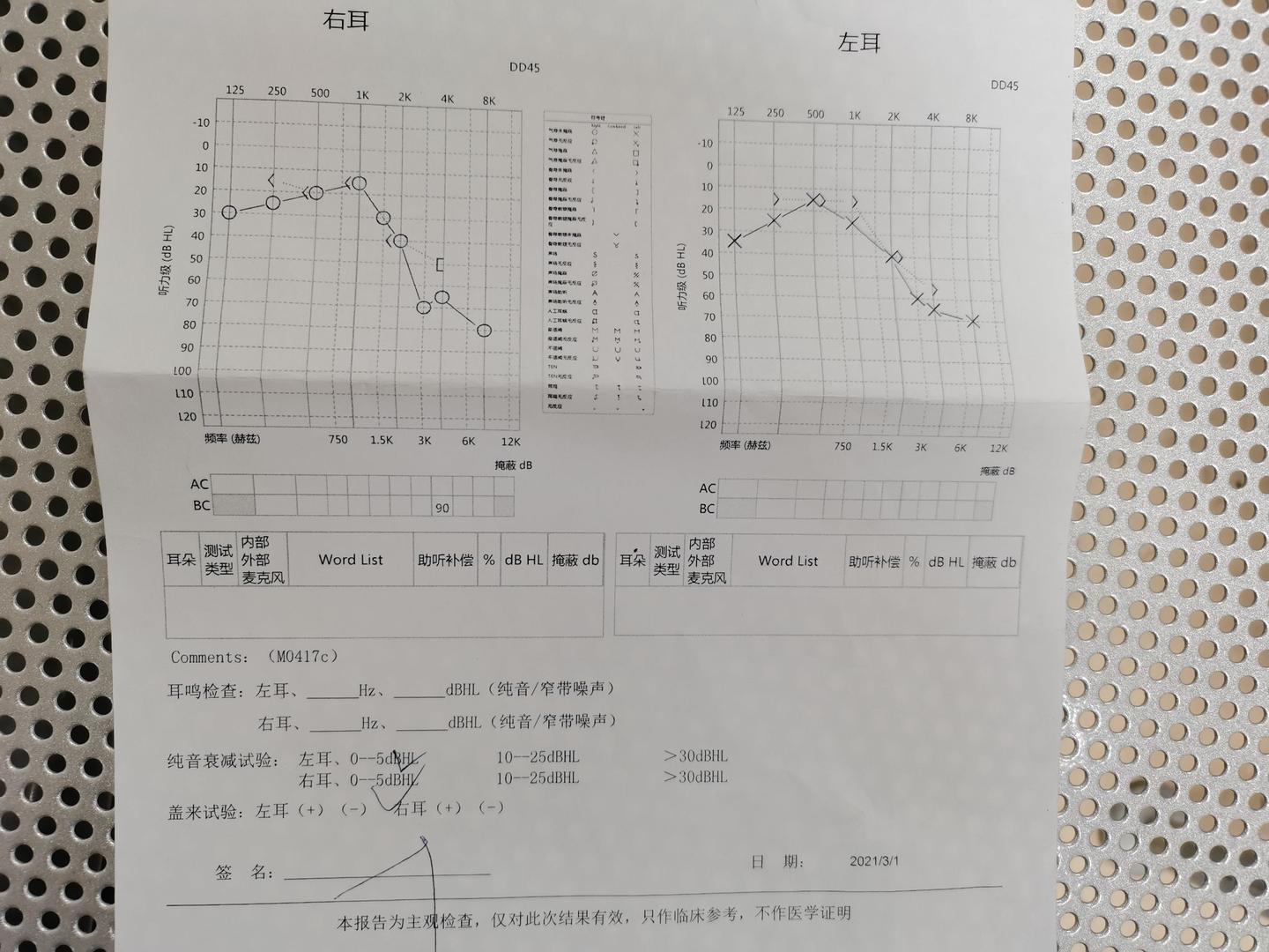 唯听110和峰力的M30那个更适合高频听力损失者？ - 知乎