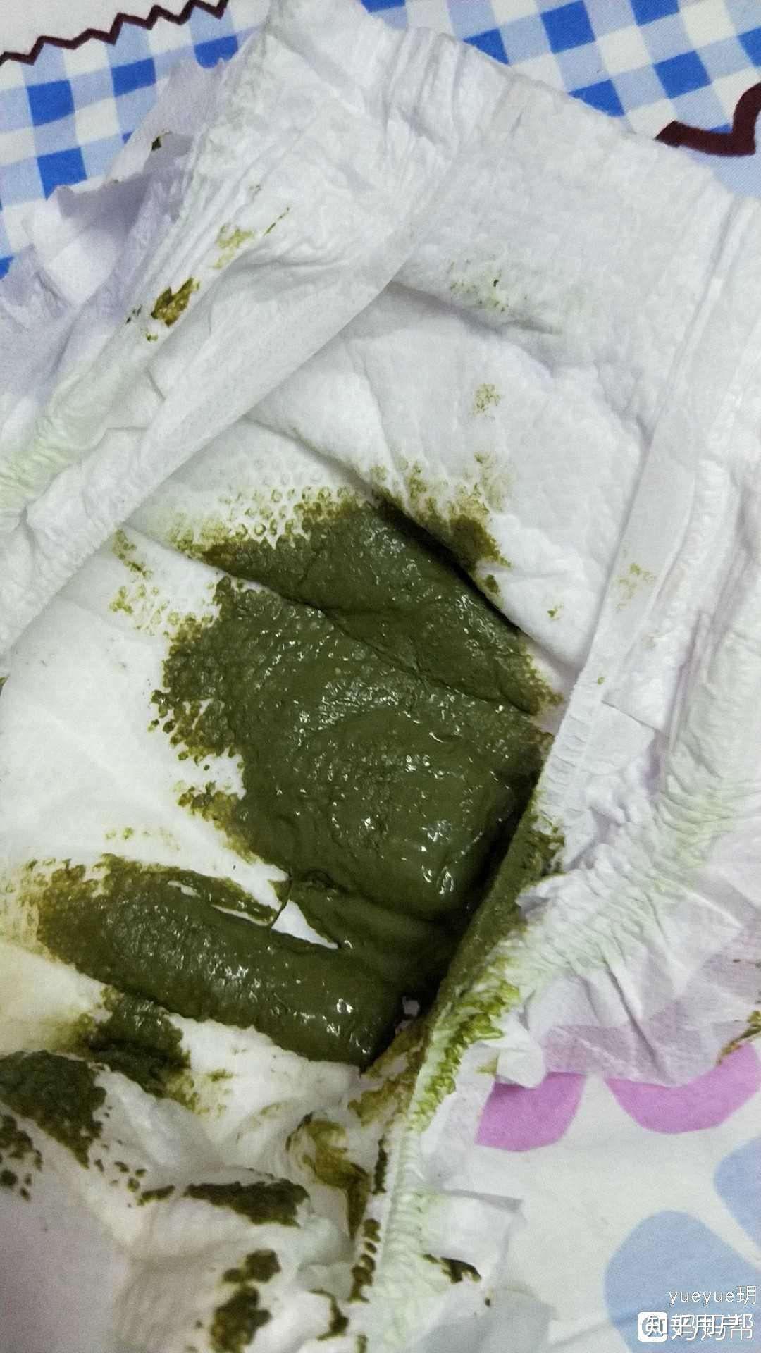 为什么孩子的大便总是绿色的
