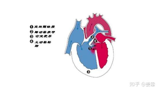 什么叫做有器质性的心脏病 v2-ee3dde1f23c9219ab81458ae26588c2f_r.jpg