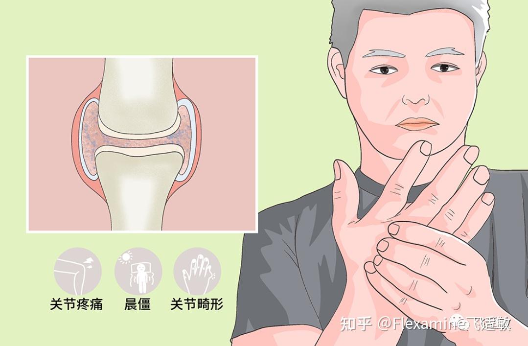 三,强直性脊柱炎