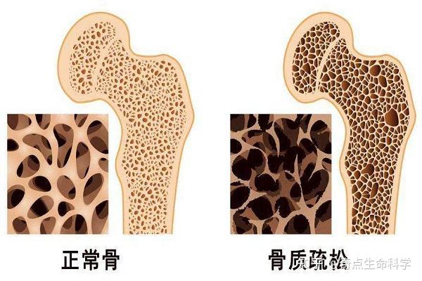 奇点生命科学讲解使用干细胞技术来缓解骨质疏松症 - 知乎
