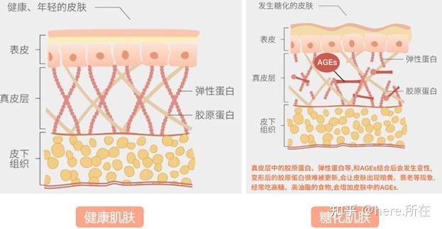 糖化对皮肤的影响