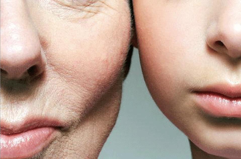 光老化就是由于日光中紫外线的长期反复照射引起的皮肤老化.