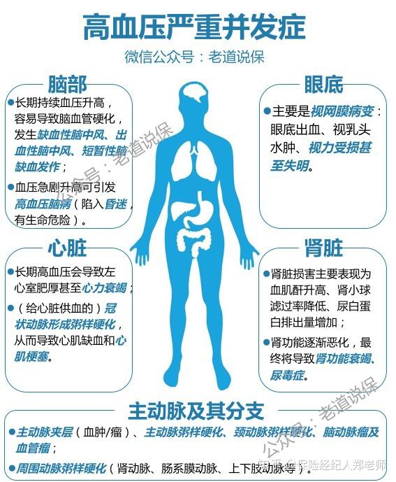 一,高血压并发症