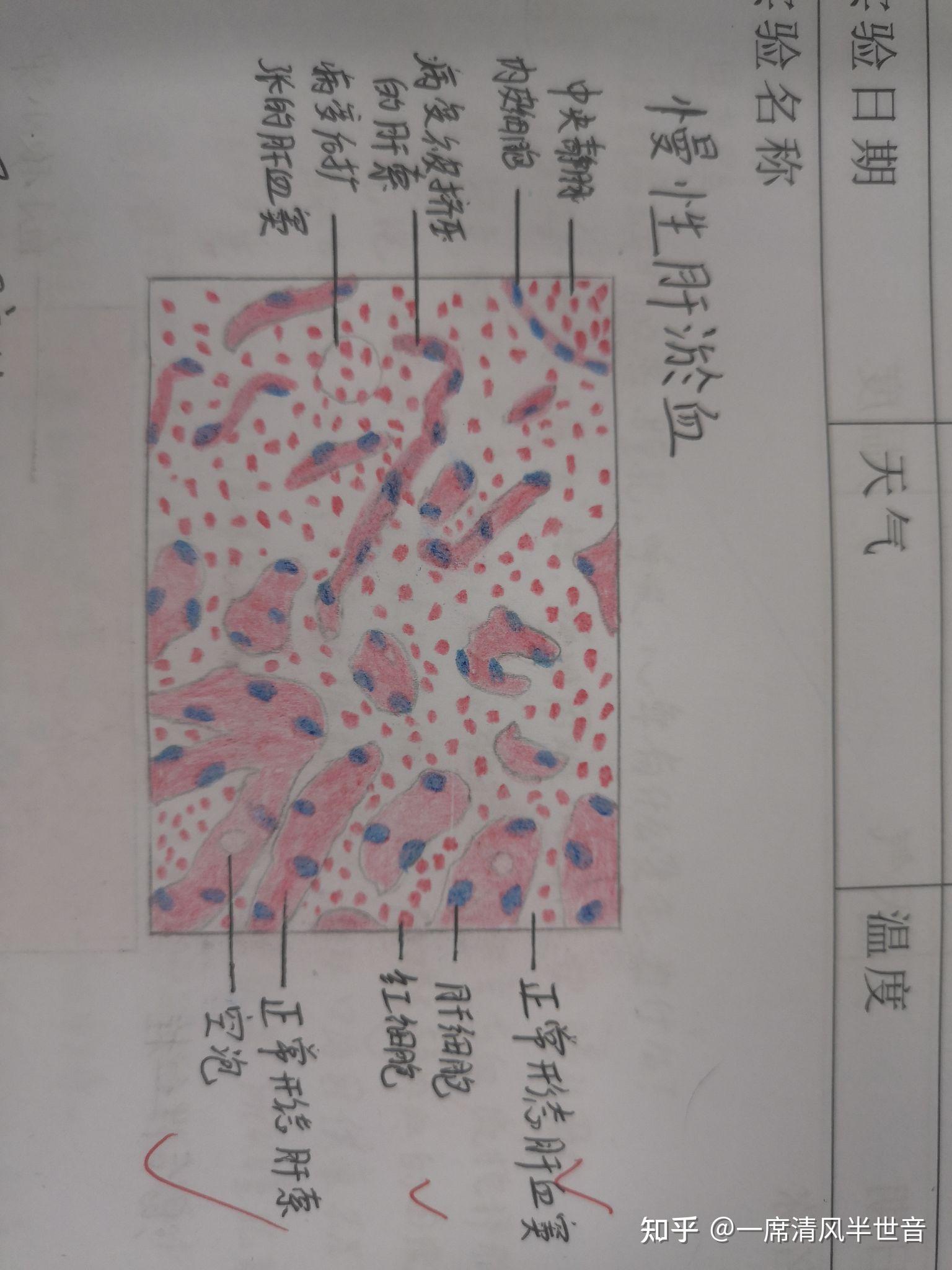 革兰染色结果手绘图图片