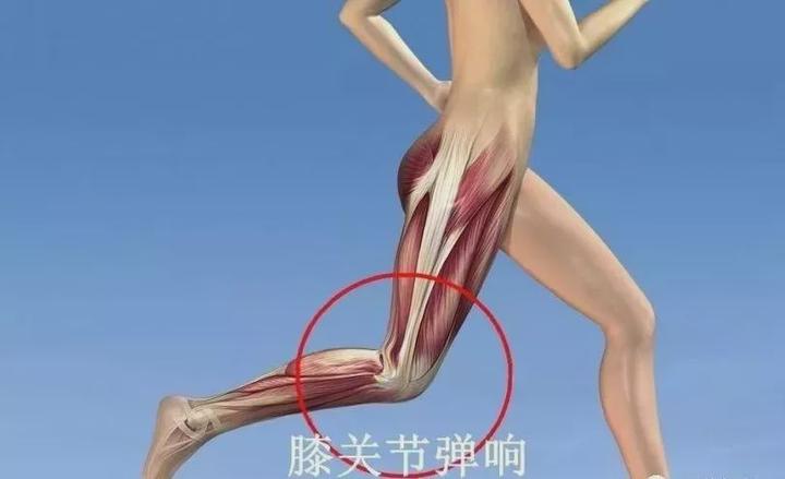 膝关节 弹响 可能是这9个问题 知乎 膝关节 弹响 可能是这9个问题 知乎