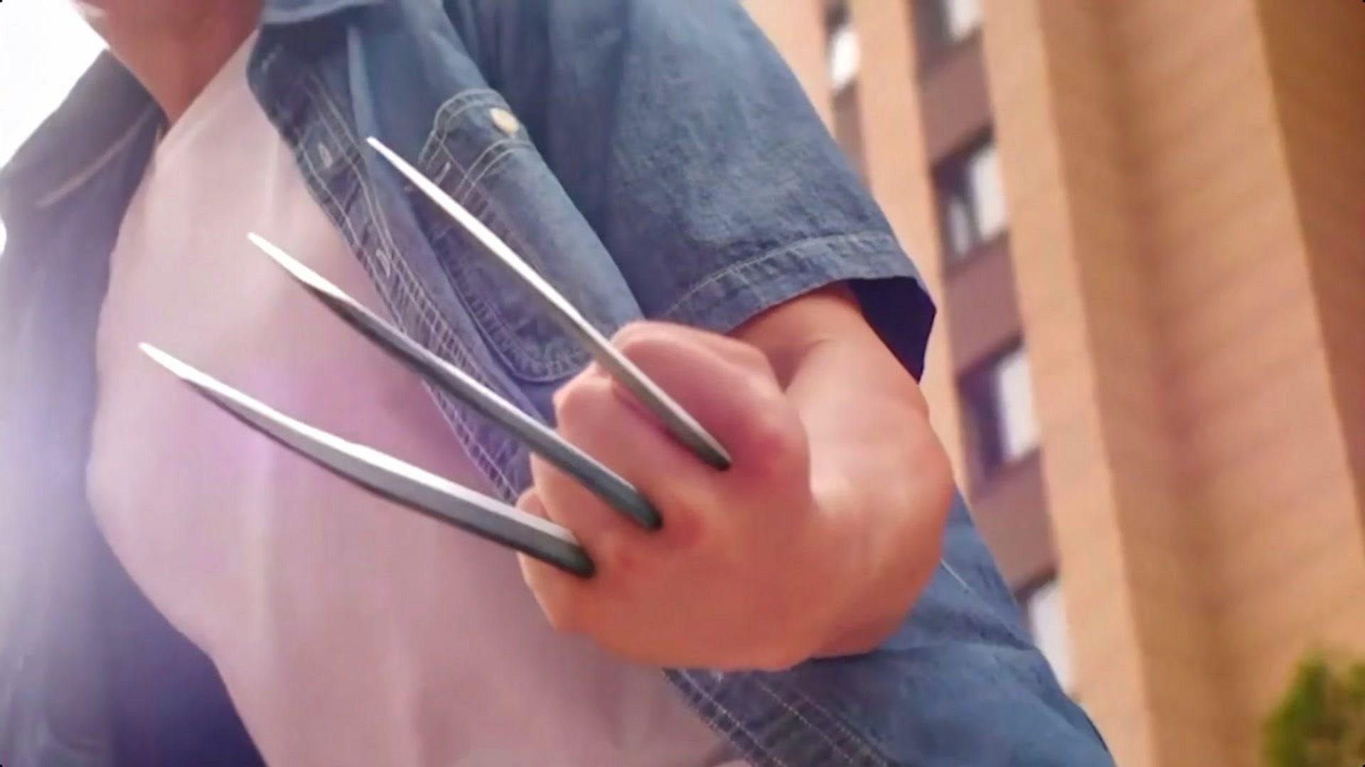 新生婴儿背部发生变异长出个奇怪的翅膀父母只能忍痛将其抛弃