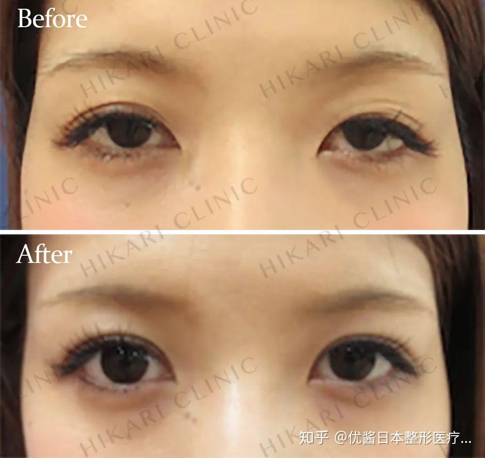 v2-ef8acdd18ee5597271e7e3eed7339e5b_r.jpg