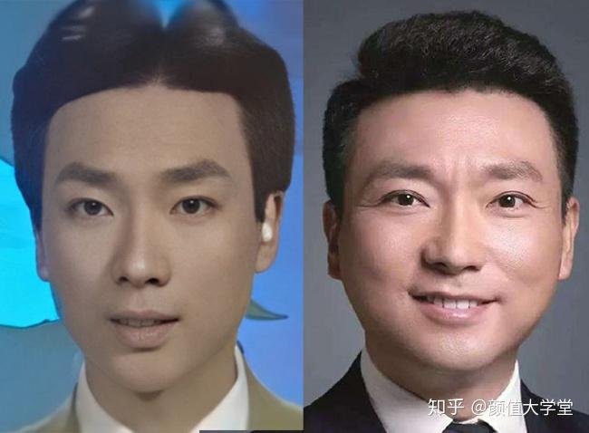 下面部宽度大于中面部颧骨间的宽度,会形成国字脸,梯形脸,硬朗过了头