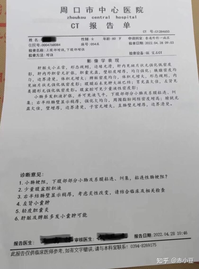 肠梗阻x线报告图片