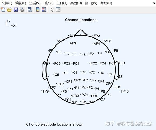 脑电技术学习笔记：脑电数据预处理学习及操作。【参考胡理老师ppt】 知乎 