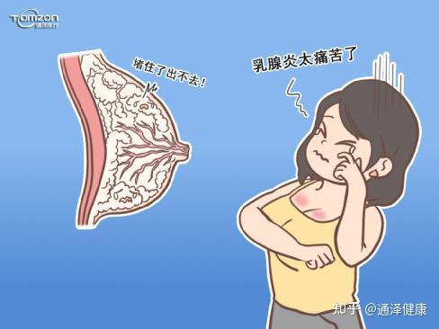 红肿,发热等情况时,可以通过冷敷的方法,减轻乳房组织水肿
