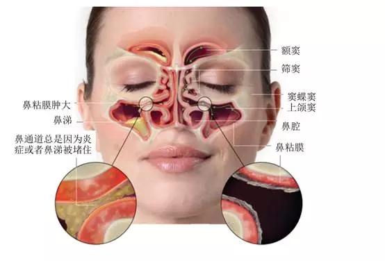 鼻子内部结构图 真实图片