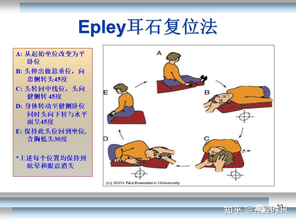 耳石症健侧卧位图解图片