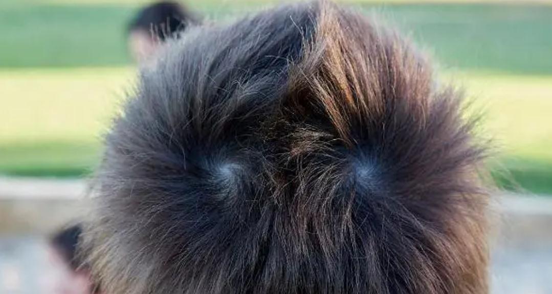 一旋傻二旋精但双旋的女孩没人要旋越多孩子越聪明