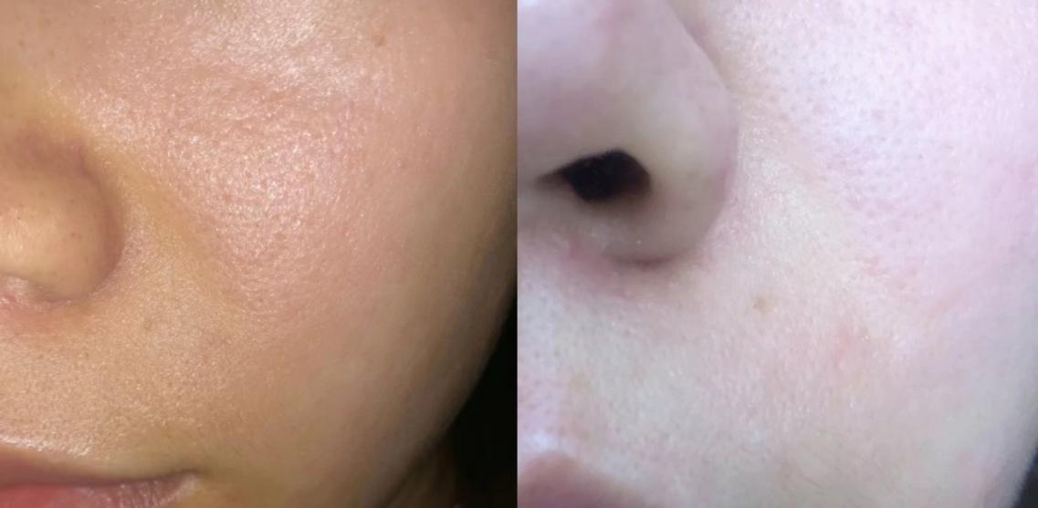 脸色不好发黄暗沉粗糙有什么精华能拯救一下