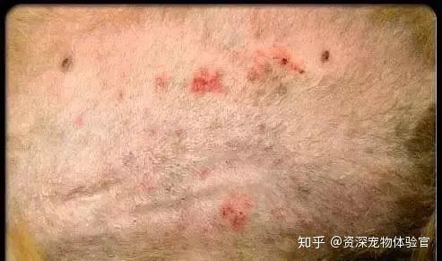 鸡虫是什么皮肤病 鸡虫皮肤病怎么治疗