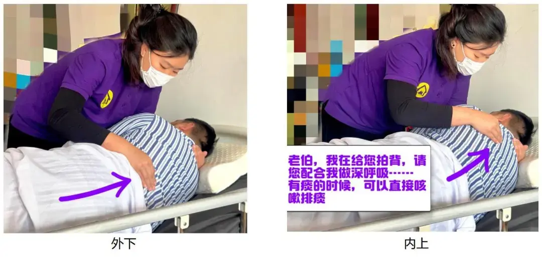 图文演示：协助排痰护理 - 知乎