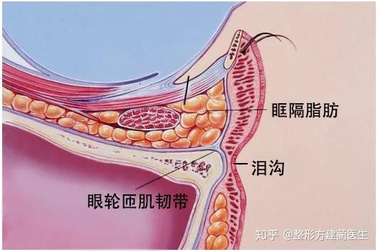 关于眶隔释放你了解多少