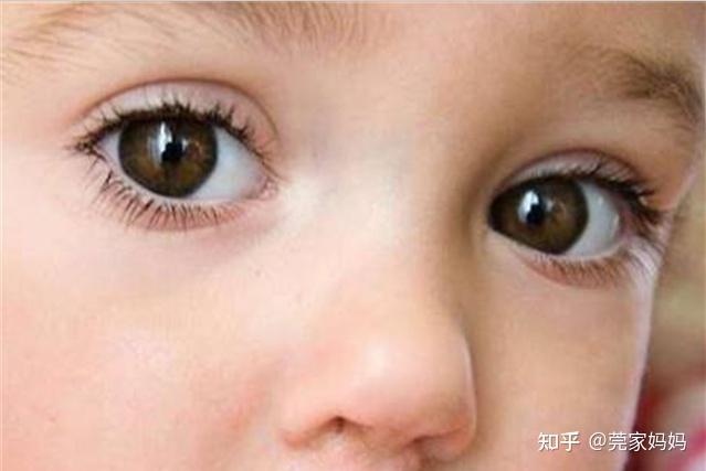 宝宝经常揉眼睛除了犯困还可能是5个原因引起家长别大意