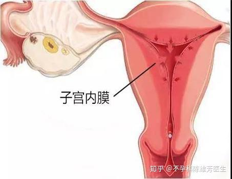 子宫内膜啥样的图片图片