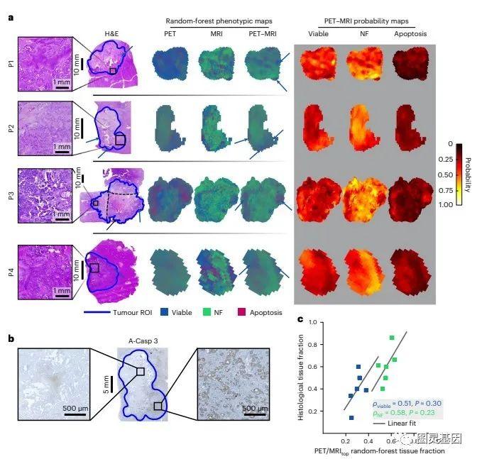 Nat Bio Eng | 德国专家完美匹配PET,MRI与病理图像，检测肿瘤异质性并提高治疗敏感性 - 知乎