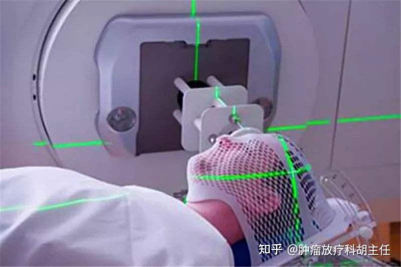 放射治疗流程和放疗科医生的工作 - 知乎