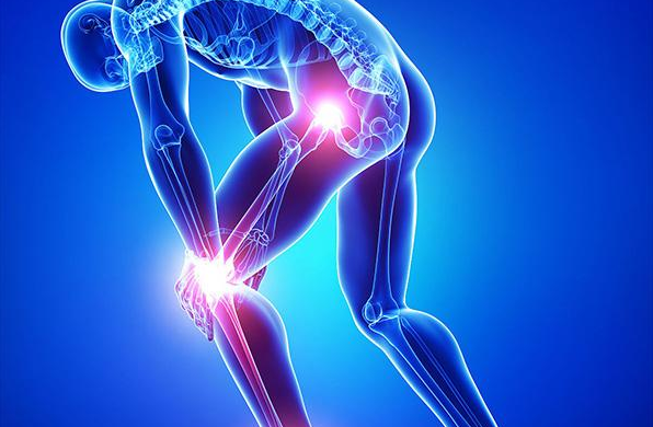 和派圆针22种引发膝关节疼痛疾病的快速诊断及鉴别