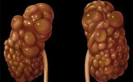 玫斯科普丨猫多囊肾如何打破家族遗传的魔咒