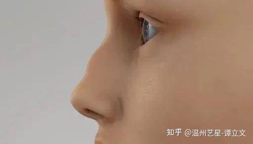 美丽分享 如何选择适合的隆鼻方式 知乎