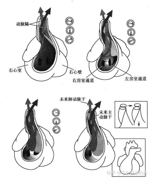 儿童正常心血管生理解剖