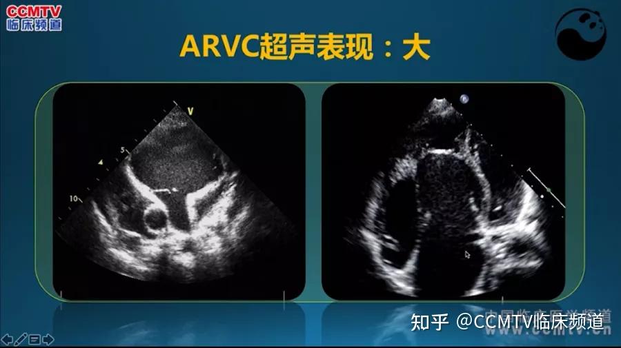 5步法读懂超声心动图90的医生都不知道