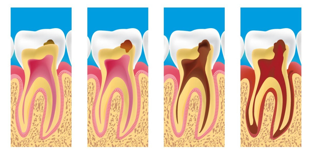 亿博电竞平台从产后牙齿敏感谈起如何正确刷牙？另附我的口腔健康专家— usmile 笑容加 F10 PRO 牙刷深度体验(图1)