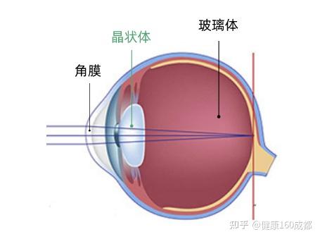 ▼晶状体就是眼睛里的这个东东1708年,赫尔曼·布尔哈夫创造性地提出