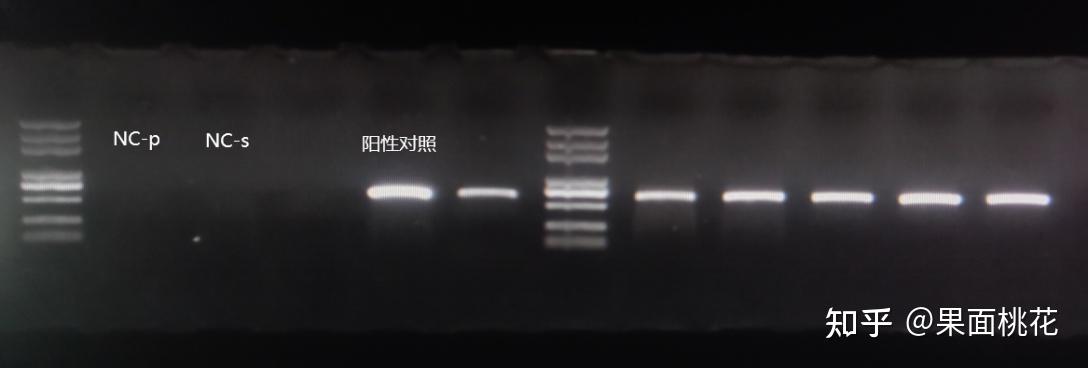 实验室扩增假阳性(气溶胶污染)的解决方法 - 知乎