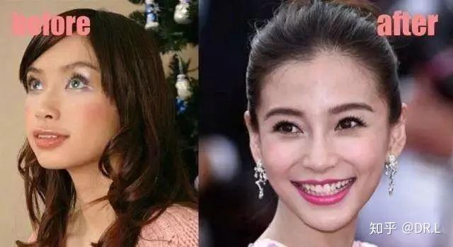 被牙齿耽误的颜值angelababy实力诠释