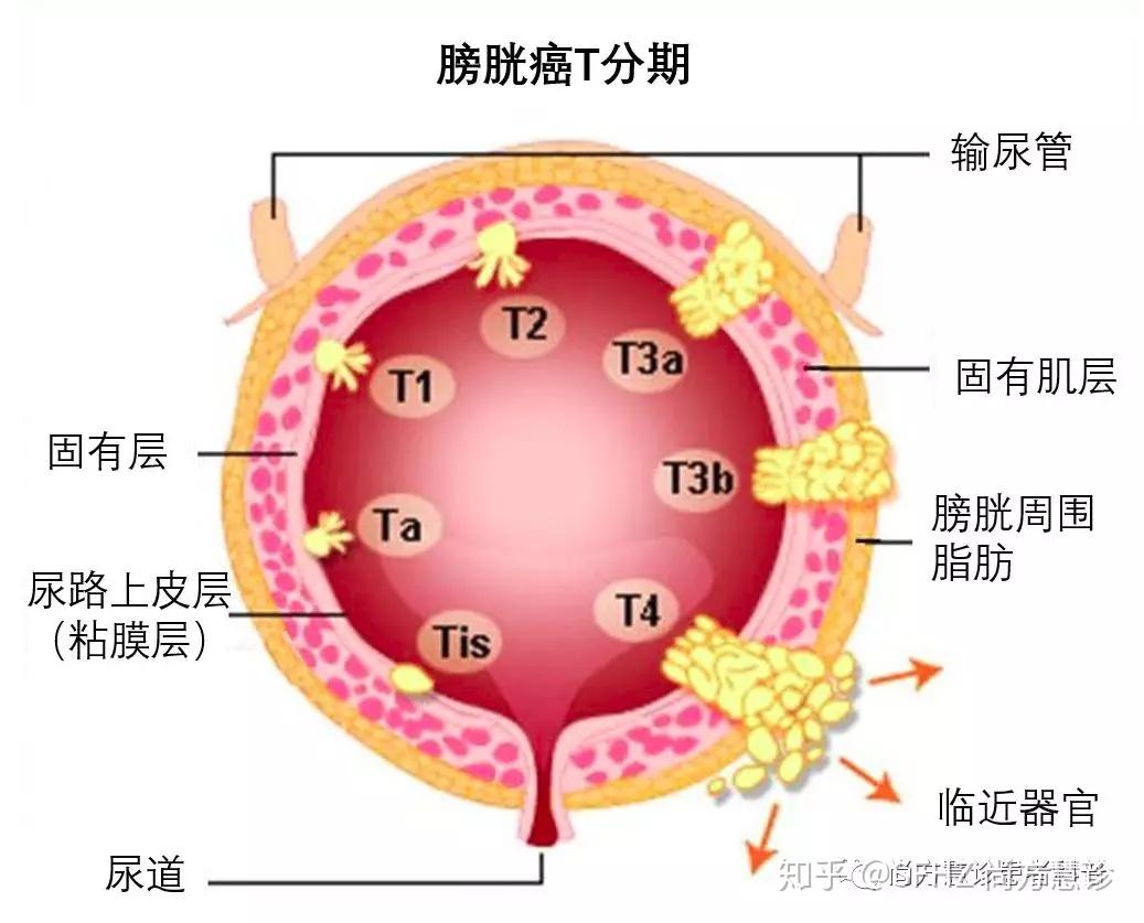 图1-111 女性膀胱和尿道(内面观)-妇产科临床解剖学-医学
