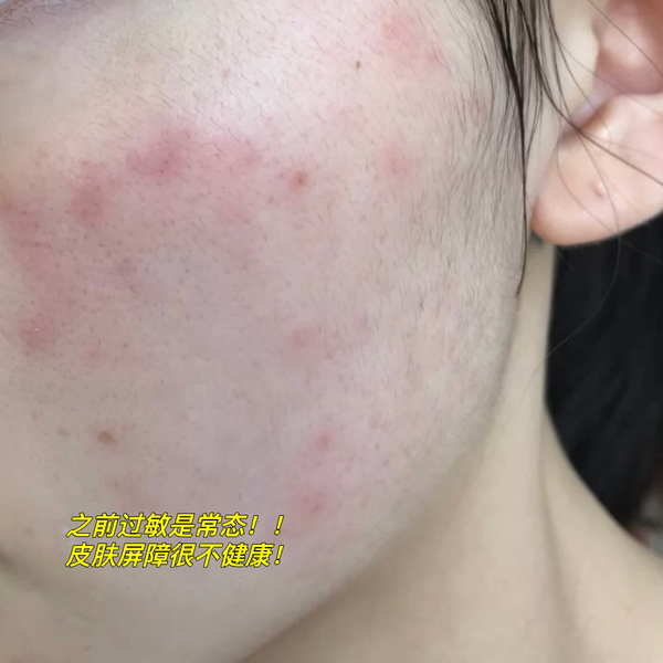 孕妇护肤保养_护肤保养步骤_孕妇该如何护肤保养