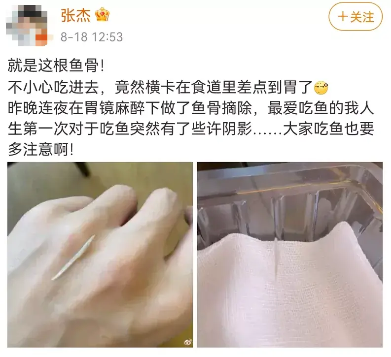 知名歌星张杰被近3厘米鱼刺卡喉他的做法请转给所有家长