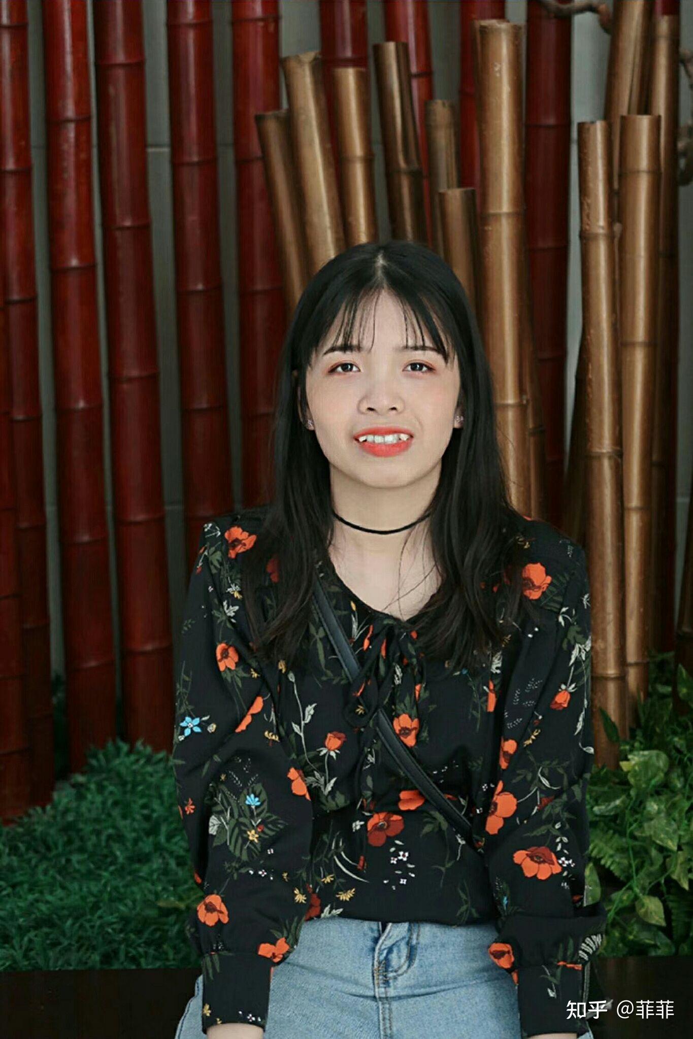 龅牙妹蜕变记录!我爱矫正555