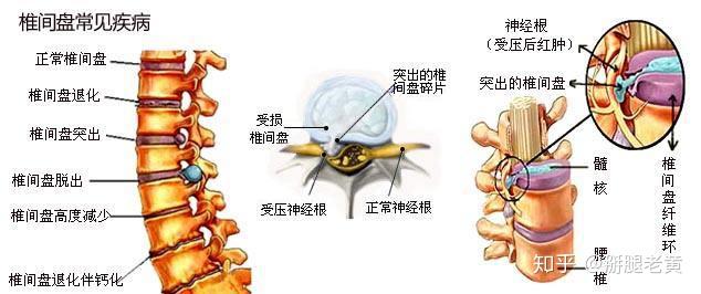 v2-f3183e2854cd479200d8a0da8c7f272f_r.jpg