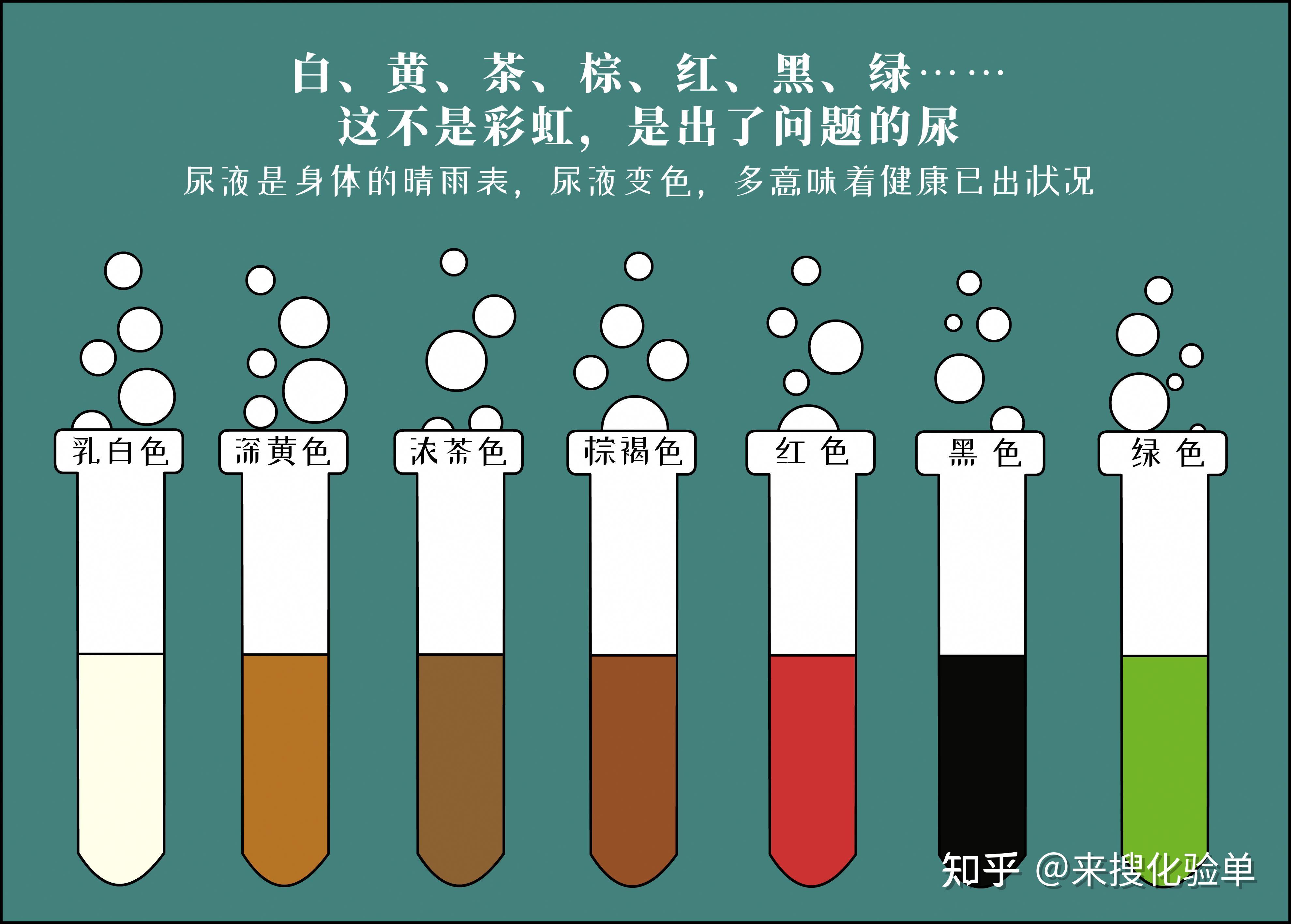 绿色:消炎药,服用亚甲蓝,靛卡红后黑色:恶性疟疾,醋中毒,黑色素瘤,尿