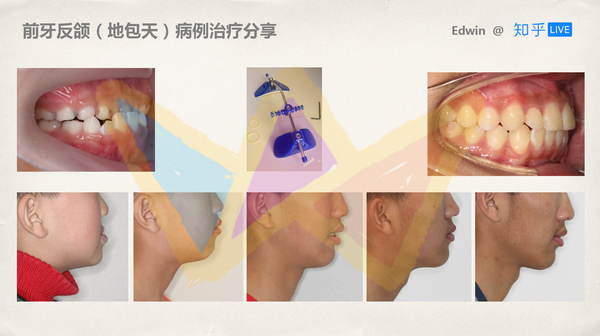 如何从小到大保护好牙齿?