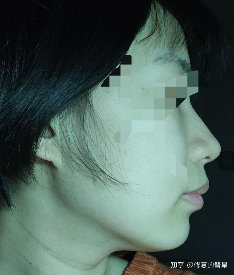 山根低鼻梁高是怎样的体验? - 知乎