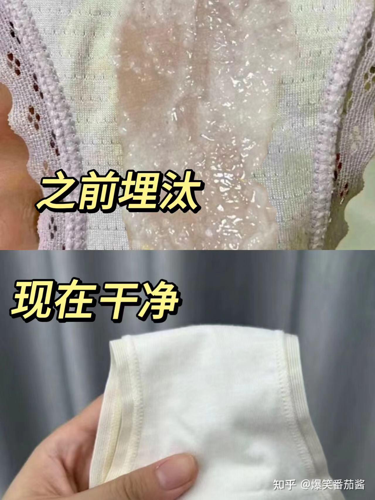 白带异常,豆腐渣,瘙痒恶臭经历者:在线分享治愈经验!