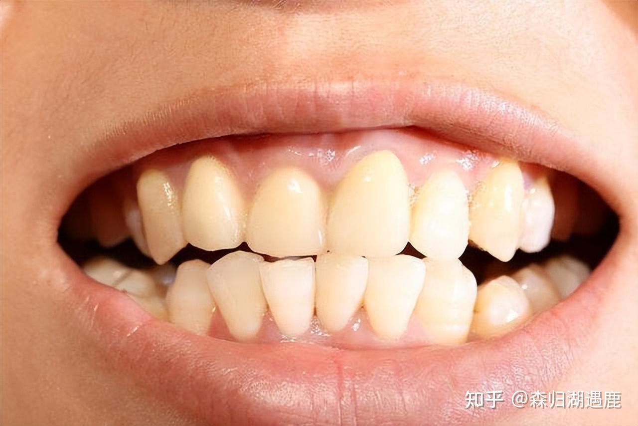 牙龈出现骨节似的东西，牙龈萎缩，牙齿松动。是什么毛病?要去什么医院治疗《北京的》_百度知道